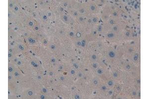 DAB staining on IHC-P; Samples: Human Liver Tissue (PIM2 抗体  (AA 82-291))