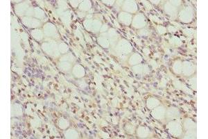 Immunohistochemistry of paraffin-embedded human colon tissue using ABIN7174024 at dilution of 1:100 (FRK 抗体  (AA 1-220))