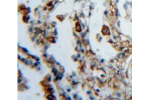 Used in DAB staining on fromalin fixed paraffin-embedded lung tissue (FES 抗体  (AA 510-770))