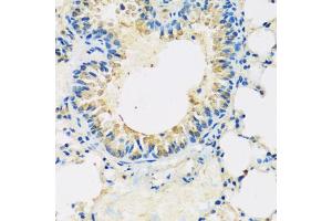 Immunohistochemistry of paraffin-embedded mouse lung using ABCF2 antibody (ABIN5972445) at dilution of 1/100 (40x lens). (ABCF2 抗体)