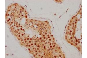 IHC image of ABIN7127350 diluted at 1:205 and staining in paraffin-embedded human testis tissue performed on a Leica BondTM system. (Recombinant ATM 抗体)