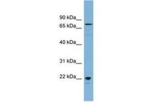Image no. 1 for anti-Membrane Protein, Palmitoylated 5 (MAGUK P55 Subfamily Member 5) (MPP5) (AA 575-624) antibody (ABIN6742119) (MPP5 抗体  (AA 575-624))