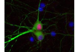 Indirect immunostaining of PFA fixed rat hippocampus neurons with anti-Tbr 1 (dilution 1 : 500; red) and mouse anti-MAP 2 (cat. (TBR1 抗体)