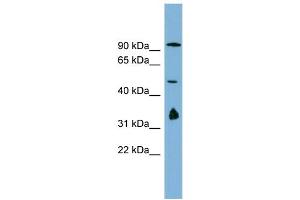 WB Suggested Anti-MAK10  Antibody Titration: 0. (MAK10/NAA35 抗体  (N-Term))