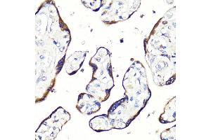 Immunohistochemistry of paraffin-embedded human placenta using HB-EGF antibody (ABIN7267617) at dilution of 1:100 (40x lens). (HBEGF 抗体  (AA 20-160))
