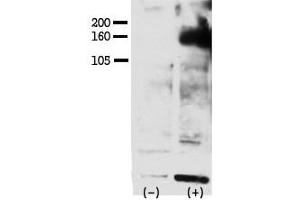 Image no. 1 for anti-V-Erb-A erythroblastic Leukemia Viral Oncogene Homolog 4 (Avian) (ERBB4) (pTyr1162) antibody (ABIN358139) (ERBB4 抗体  (pTyr1162))
