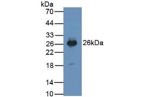 Detection of PTGDS in Human Urine using Monoclonal Antibody to Prostaglandin-H2 D-isomerase (PTGDS) (PTGDS 抗体  (AA 32-190))