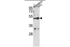 Western blot analysis of CEP55 Antibody (N-term) in MDA-MB231, T47D cell line lysates (35ug/lane). (CEP55 抗体  (N-Term))