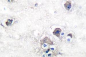 Image no. 2 for anti-Peripherin (PRPH) antibody (ABIN271783) (Peripherin 抗体)
