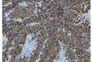 Immunohistochemistry (IHC) image for anti-Profilin 1 (PFN1) (C-Term) antibody (ABIN6264161)