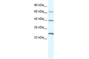 GJC1 antibody used at 5 ug/ml to detect target protein. (GJC1 抗体  (N-Term))