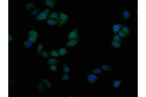 Immunofluorescence staining of Hela cells with ABIN7169724 at 1:50, counter-stained with DAPI. (SIM1 抗体  (AA 347-434))