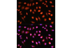 Immunofluorescence analysis of L929 cells using // antibody (ABIN7265520) at dilution of 1:100. (AKT 1/2/3 抗体)