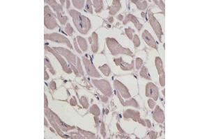Immunohistochemistry (Paraffin-embedded Sections) (IHC (p)) image for anti-Myosin, Light Chain 1, Alkali, Skeletal, Fast (MYL1) (AA 101-135) antibody (ABIN6243894)