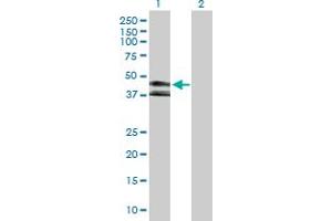 Western Blotting (WB) image for anti-Killer Cell Immunoglobulin-Like Receptor, three Domains, Long Cytoplasmic Tail, 1 (KIR3DL1) (AA 1-382) antibody (ABIN517339)