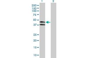 Western Blot analysis of KIR3DL1 expression in transfected 293T cell line by KIR3DL1 MaxPab polyclonal antibody. (KIR3DL1 抗体  (AA 1-382))