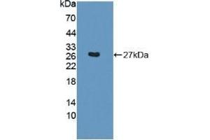 Detection of Recombinant SNAP23, Mouse using Polyclonal Antibody to Synaptosomal Associated Protein 23 kDa (SNAP23) (SNAP23 抗体  (AA 1-210))