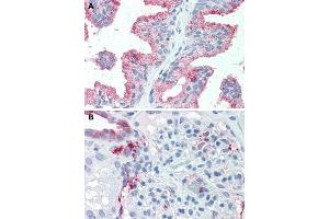 Immunohistochemical staining of human prostate (A) and human kidney (B) with SLC39A14 polyclonal antibody . (SLC39A14 抗体  (Internal Region))