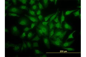 Immunofluorescence of monoclonal antibody to YBX1 on HeLa cell. (YBX1 抗体  (AA 51-139))