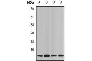 Western blot analysis of Neurokinin B expression in Jurkat (A), mouse spleen (B), rat kindney (C), rat brain (D) whole cell lysates. (Tachykinin 3 抗体)
