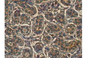 Immunohistochemistry (IHC) image for anti-RAB11B, Member RAS Oncogene Family (RAB11B) (C-Term) antibody (ABIN1440027)