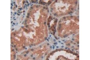 Figure. (HSPB2 抗体  (AA 12-182))