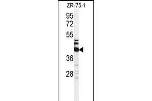 Western blot analysis of KRT35 Antibody (C-term) (ABIN651184 and ABIN2840116) in ZR-75-1 cell line lysates (35 μg/lane). (Keratin 35 抗体  (C-Term))