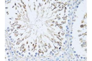 Immunohistochemistry of paraffin-embedded rat testis using TEFM antibody (ABIN5974873) at dilution of 1/100 (40x lens). (TEFM 抗体)
