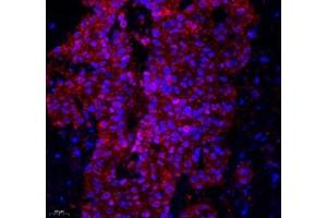 Immunofluorescence of paraffin embedded human colon using Lat (ABIN7074502) at dilution of 1: 2100 (400x lens) (LAT 抗体)