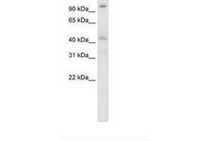 Image no. 3 for anti-Pogo Transposable Element with ZNF Domain (POGZ) (N-Term) antibody (ABIN203011) (POGZ 抗体  (N-Term))