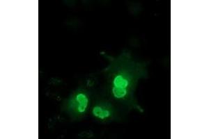 Anti-EPM2AIP1 mouse monoclonal antibody (ABIN2452999) immunofluorescent staining of COS7 cells transiently transfected by pCMV6-ENTRY EPM2AIP1 (RC209239). (EPM2AIP1 抗体)