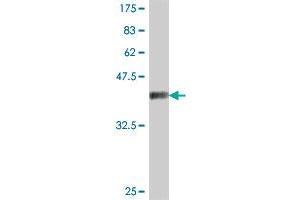 Western Blotting (WB) image for anti-Eukaryotic Translation Initiation Factor 4E Nuclear Import Factor 1 (EIF4ENIF1) (AA 886-985) antibody (ABIN566025)