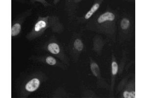 Immunofluorescent staining of HeLa (ATCC CCL-2) cells. (Cyclin A 抗体  (AA 26-144))