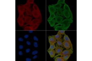 ABIN6257093 and ABIN6273472 staining Hela cells(30 min of UV treatment) by IF/ICC.