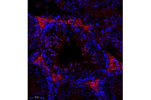 Immunofluorescence of paraffin embedded mouse testis using Cep78 (ABIN7073432) at dilution of 1:400 (300x lens) (CEP78 抗体)