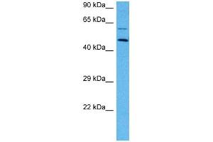 Host:  Mouse  Target Name:  EPOR  Sample Tissue:  Mouse Skeletal Muscle  Antibody Dilution:  1ug/ml (EPOR 抗体  (N-Term))