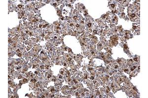 Immunohistochemistry (IHC) image for anti-Acyl-CoA Synthetase Long-Chain Family Member 4 (ACSL4) (C-Term) antibody (ABIN2854678)