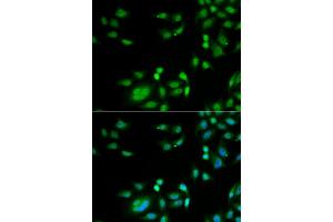 Immunofluorescence analysis of A549 cells using INTS10 antibody. (INTS10 抗体)