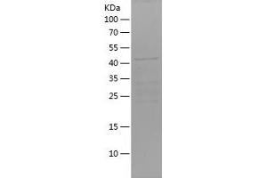 Foxo6 Protein (AA 123-342) (His-IF2DI Tag)