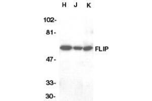 Western blot analysis of FLIP in HeLa (H), Jurkat (J), and K562 (K) whole cell lysate with AP30342PU-N FLIP antibody at 1/1000 dilution. (FLIP 抗体  (C-Term))