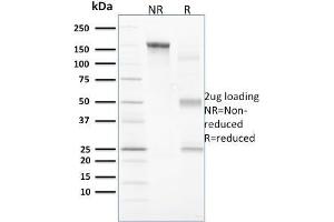 SDS-PAGE Analysis Purified Vinculin Mouse Monoclonal Antibody (VCL/2573). (Vinculin 抗体  (AA 174-322))