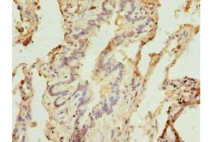 Immunohistochemistry of paraffin-embedded human lung tissue using ABIN7171242 at dilution of 1:100 (Syntaxin 5 抗体  (AA 55-355))