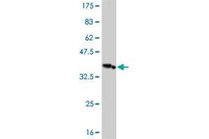 Western Blot detection against Immunogen (36. (IRAK3 抗体  (AA 497-596))