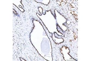 IHC analysis of DDX1 using anti-DDX1 antibody (ABIN7602052). (DDX1 抗体  (AA 562-740))