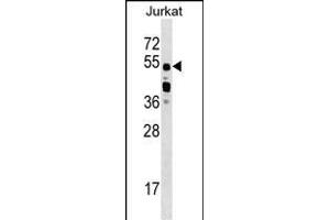 CUGBP2 Antibody (C-term) (ABIN1537389 and ABIN2848868) western blot analysis in Jurkat cell line lysates (35 μg/lane). (CELF2 抗体  (C-Term))