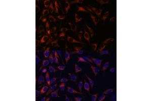 Immunofluorescence analysis of L929 cells using WFDC1 antibody (ABIN7271344) at dilution of 1:100. (WFDC1 抗体  (AA 111-220))