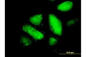 Immunofluorescence (IF) image for anti-Glutathione Transferase zeta 1 (Maleylacetoacetate Isomerase) (GSTZ1) (AA 109-216) antibody (ABIN516249)