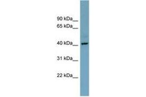 CXorf66 抗体  (AA 215-264)