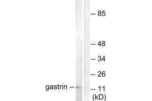 Western blot analysis of extracts from NIH/3T3 cells, using Gastrin antibody. (Gastrin 抗体)