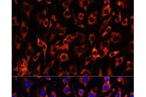 Immunofluorescence analysis of C6 cells using MCTS1 Polyclonal Antibody at dilution of 1:100 (40x lens). (MCTS1 抗体)